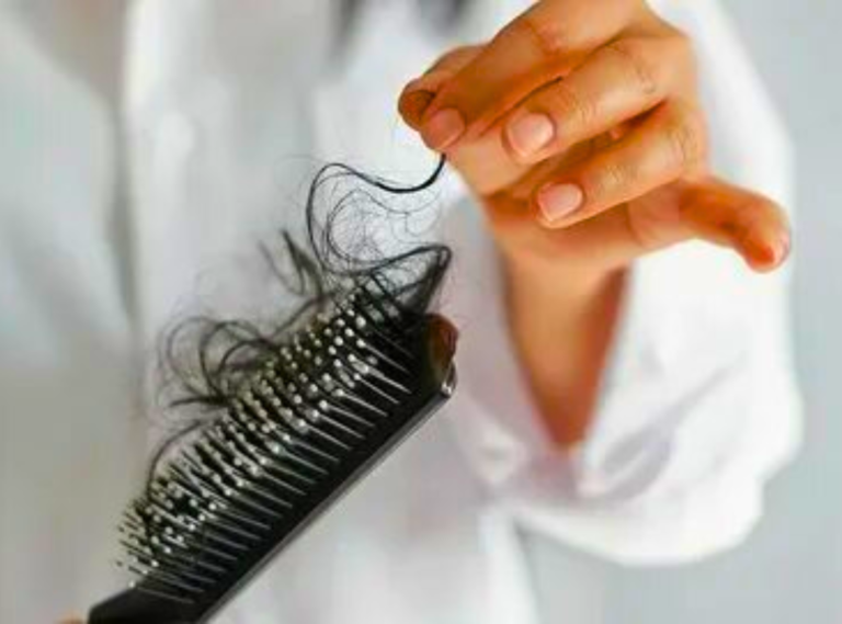 menopause hair fall