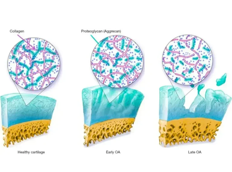 marine collagen supplemen