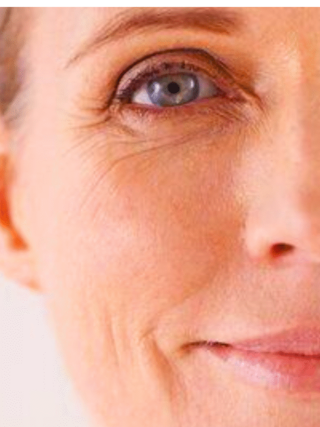wrinkles on the face