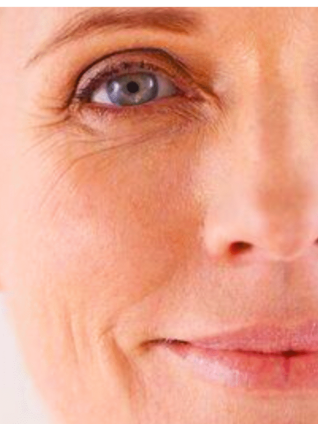 Wrinkles in Menopause