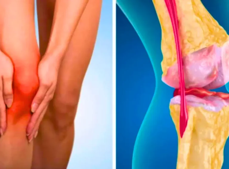 Find out how to reduce joint pain in menopause with prevention,