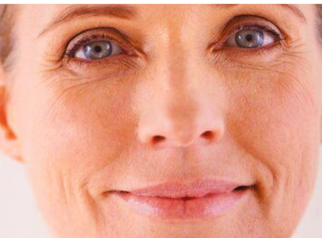 wrinkles on the face