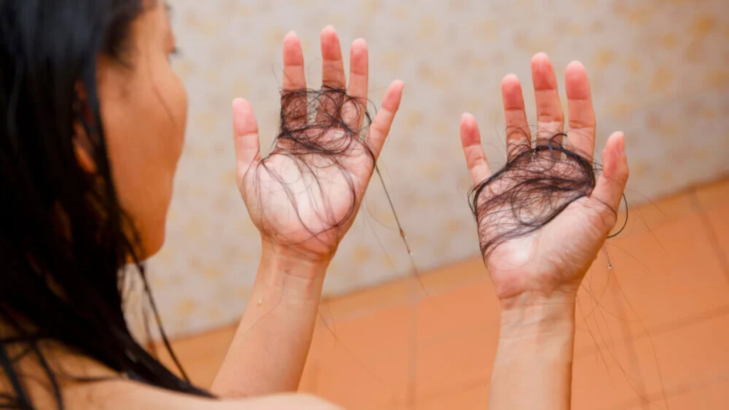 Hair loss