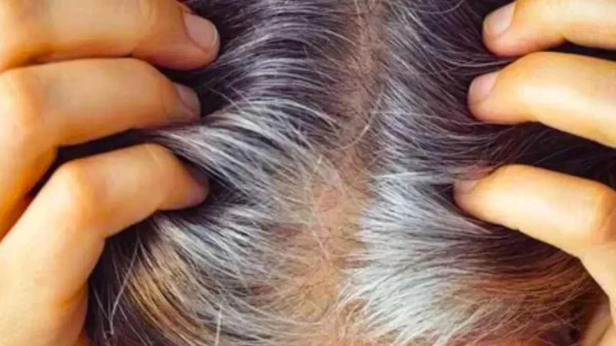 hair loss during menopause
