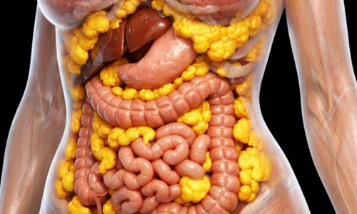 anti-Inflammatory foods