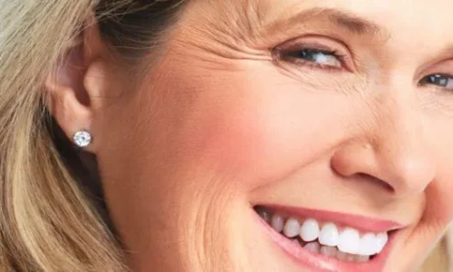 Menopause and Wrinkles: Tips to Manage Aging