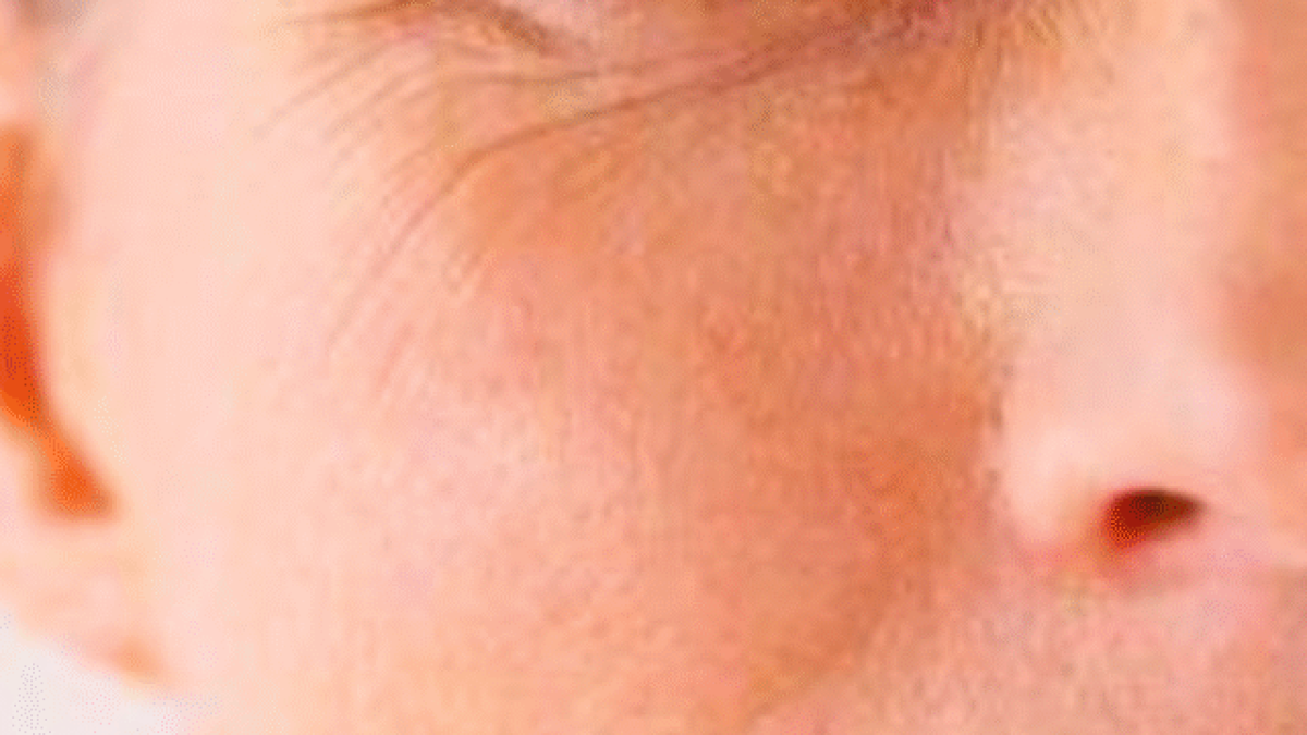wrinkles on the face