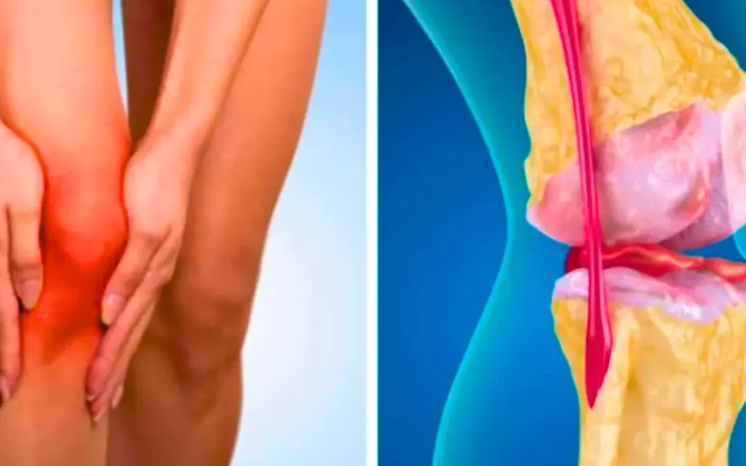 Find out how to reduce joint pain in menopause with prevention,