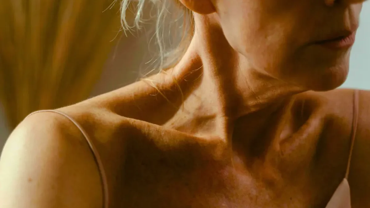 Sarcopenia after menopause