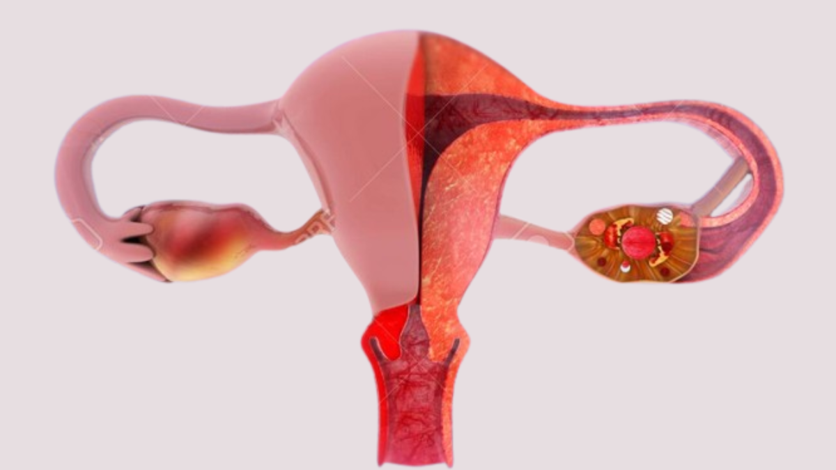 menopause vaginal dryness