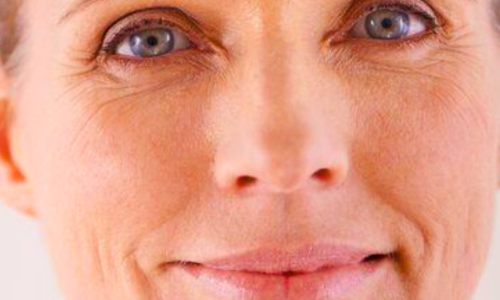 Wrinkles in Menopause: Why They Appear and How to Improve Them Naturally and Effectively