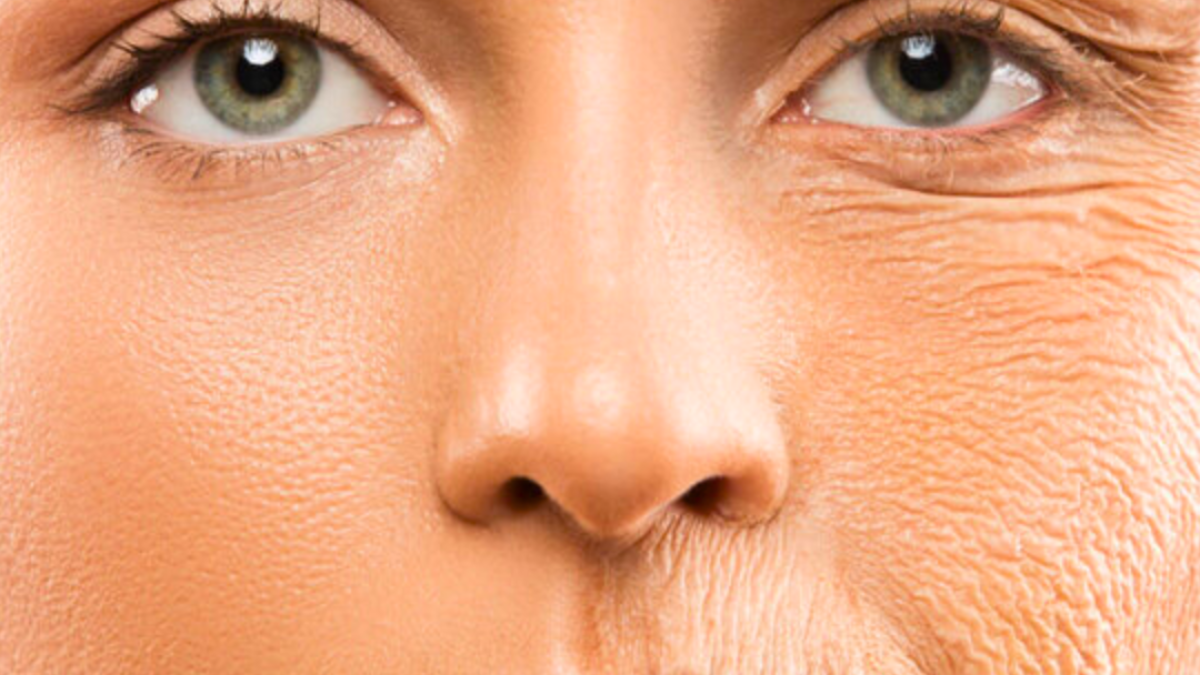 wrinkles and menopause